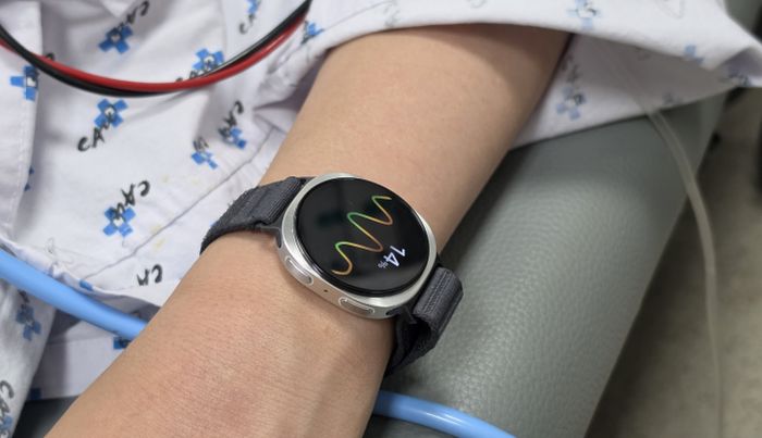 Samsung prvi u svetu predstavio rešenje za predviđanje nesvestice uz pomoć Galaxy Watch uređaja
